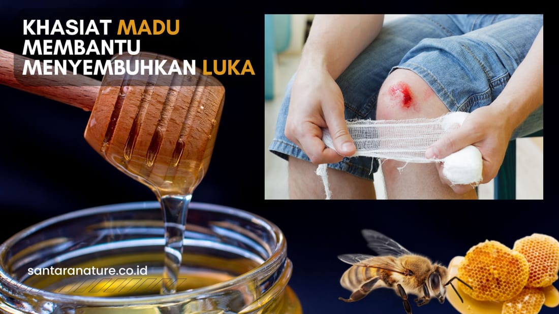 Khasiat Madu Membantu Menyembuhkan Luka
